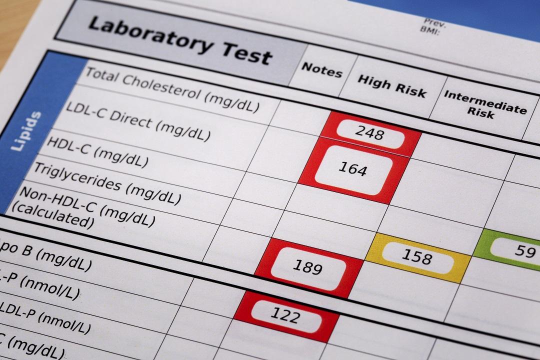 Lipid Values Small File