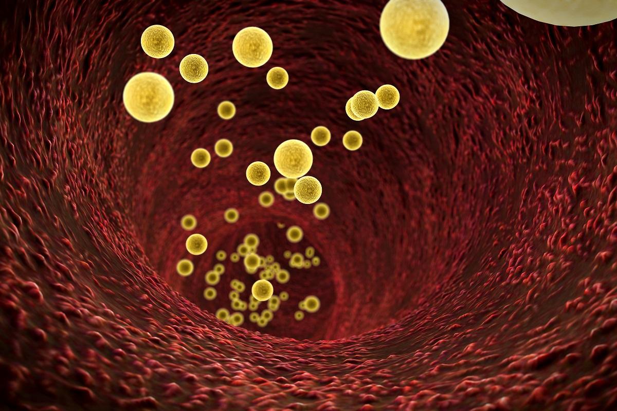 Lipids in Circulation Small File